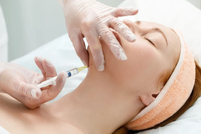 Top Benefits of Kybella Injections in Tiverton, RI: A Comprehensive Guide